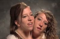 Abby Hensel s’est mariée et a un bébé, mais sa sœur siamoise Brittany reste célibataire : comment cela fonctionne-t-il au quotidien ?